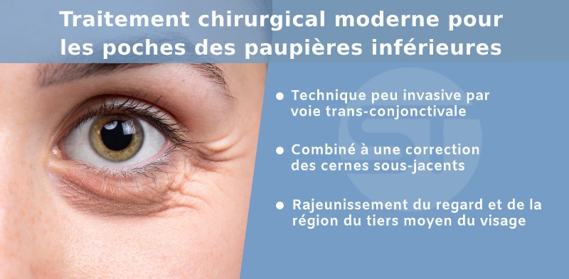 Chirurgie pour les poches des paupières inférieures