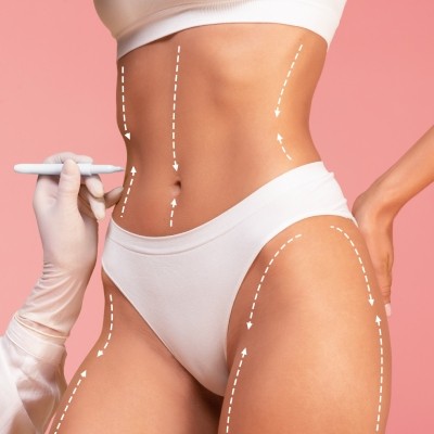 Cryolipolyse ou liposuccion en Wallonie : nos indications