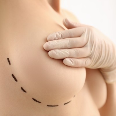 Atouts des implants mammaires en sérum physiologique en Wallonie