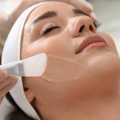 Peeling du visage dans le Hainaut et le nord de la France